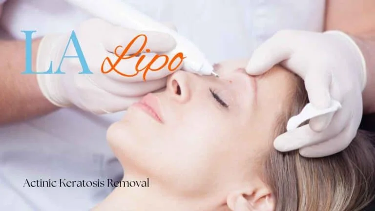 Woman receiving Actinic Keratosis Removal Treatment Leyton