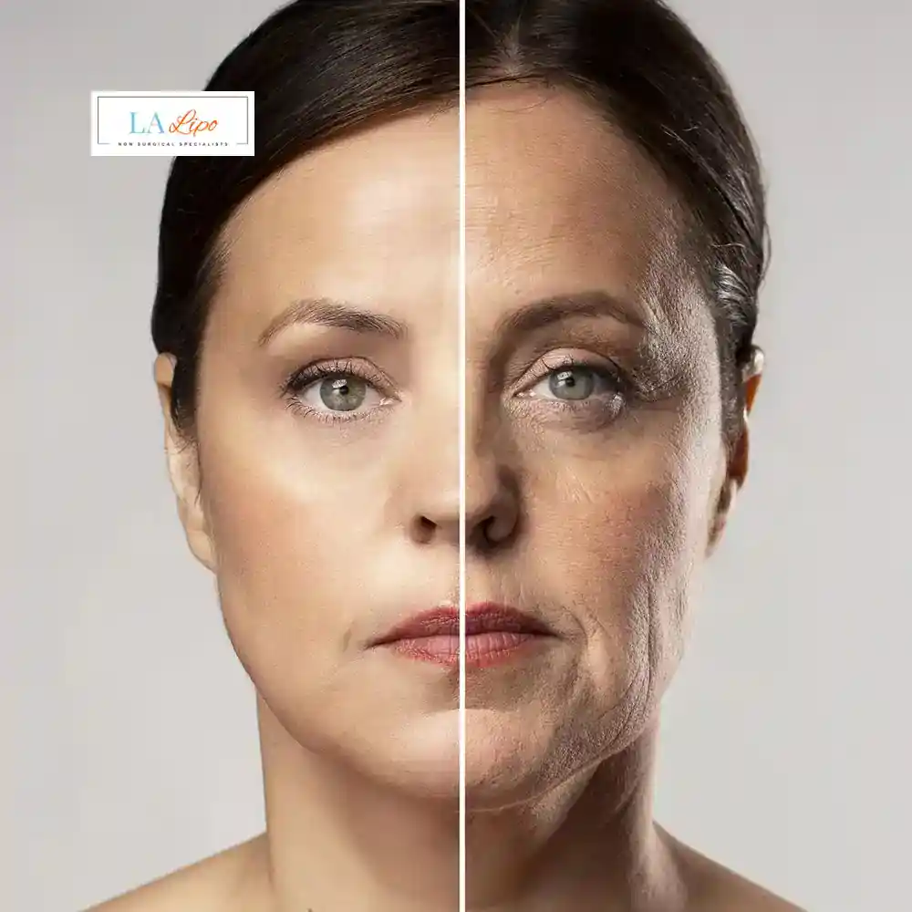How Can You Tell If Non-Surgical Skin Tightening Is Right for You Leyton?