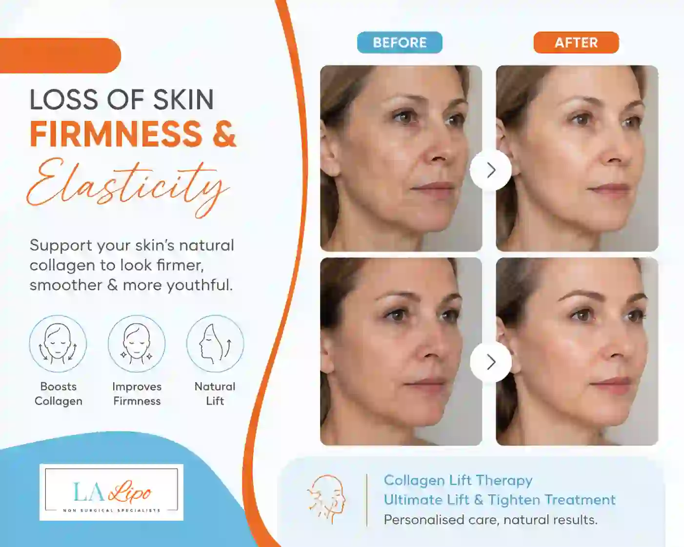 Sign #7: Loss of Skin Firmness and Elasticity Leyton